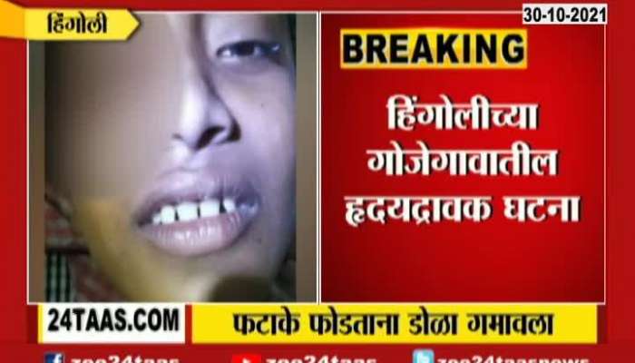 Hingoli Nine Year Old Lost His Eye In Bursting Fire Crackers