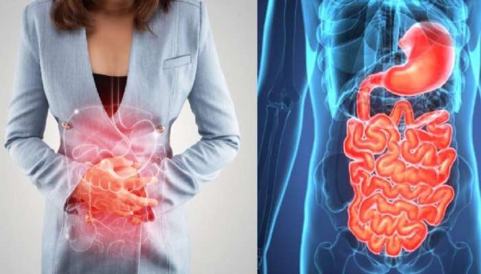 Healthy Digestion: पचनाची समस्या असेल तर आहारात या 5 गोष्टींचा करा समावेश