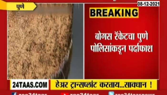 Pune Police Busted Hair Trasnsplant Racket