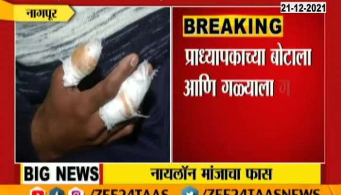 Nagpur Rajesh Kshirsagar injured due to Nylon Thread