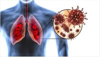 Omicron And Lungs : ओमायक्रॉन फुफ्फुसाकरता किती घातक? अभ्यासात खुलासा 