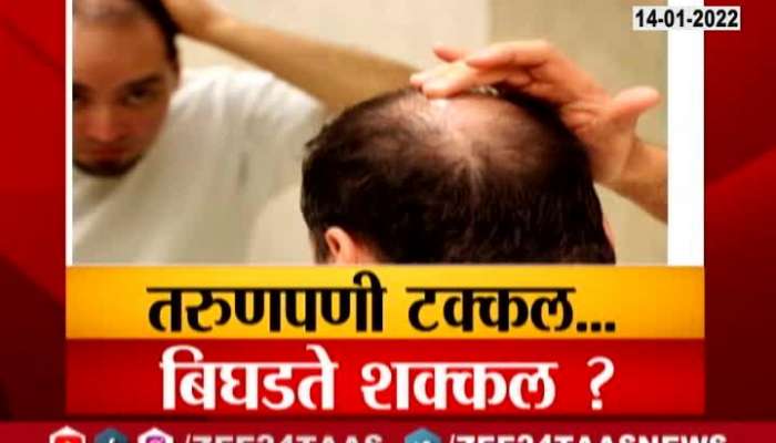 Aurangabad Growing Trend Towards Hair Transplantation
