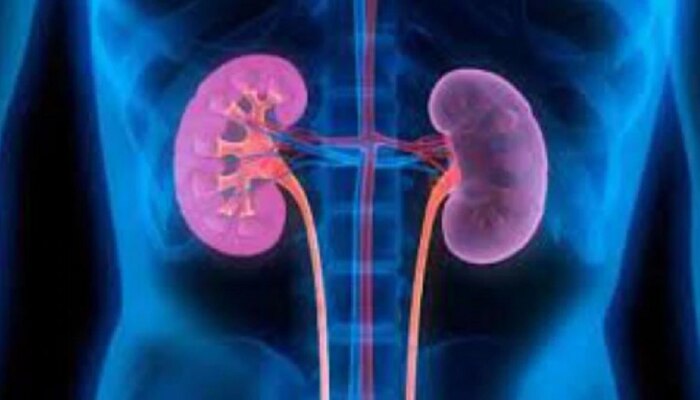 Kidney Disease : किडनी खराब झाल्यावर शरीरात दिसू लागतात ही 5 लक्षणे, जाणून घ्या माहिती