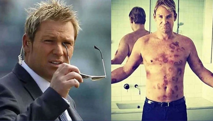 सेक्स स्कँडल, Shane Warne आणि त्याचा नर्ससोबतचा &#039;हा&#039; किस्सा