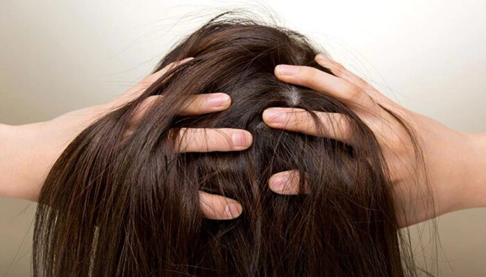 Hair Roots Pain : तुमच्याही केसांची मुळं दुखतायत? नक्का करा हे उपाय, आराम मिळालाच म्हणून समजा 
