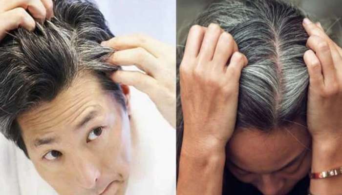 what causes white hair at early age News in Marathi, Latest what causes  white hair at early age news, photos, videos | Zee News Marathi