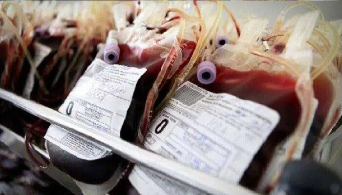 धक्कादायक! दुषित रक्तामुळे चार बालकांना HIVची लागण, एका बालकाचा मृत्यू