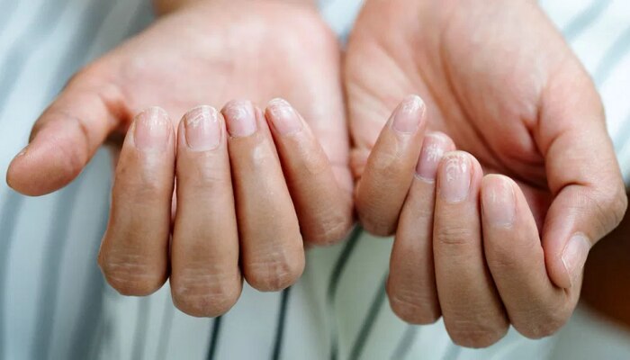 Nails Care Tips: अशी घ्या तुमच्या नखांची काळजी, नाहीतर पडेल महागात