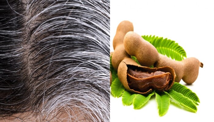white hair treatment News in Marathi, Latest white hair treatment news, photos, videos | Zee News Marathi white hair treatment News in Marathi, Latest white hair treatment news, photos, videos | Zee News Marathi