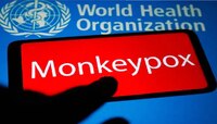 Monkeypox Virus:  मंकीपॉक्स विषाणूचं नाव बदलणार, WHO ने सांगितलं यामागचं कारण