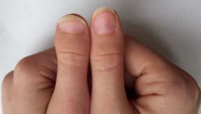 Palmistry: तुमच्याही हाताचा अंगठा वाकलाय का? पहा मग तुमच्या स्वभाव कसा आहे...