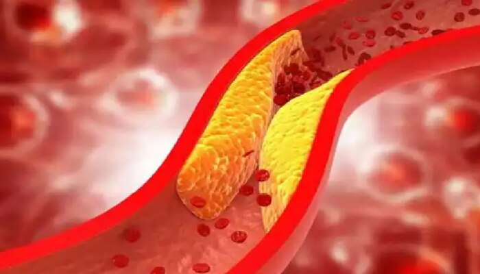 &#039;या&#039; 3 ड्रिंक्सच्या मदतीने कमी करा Cholesterol ची पातळी!