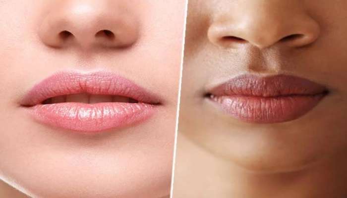 Dark lips treatment | ओठ काळे पडताय? वापरा हे घरगुती सोपे उपाय