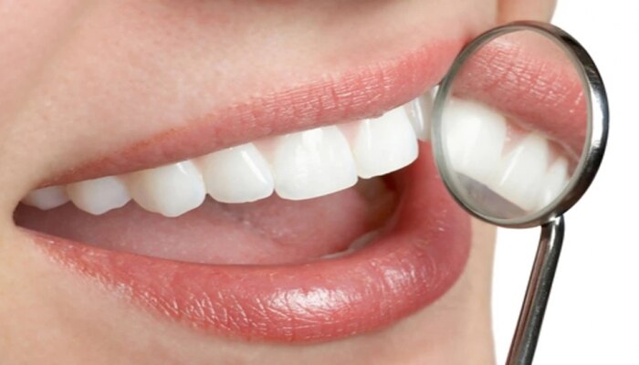 दात किडण्याच्या समस्येने त्रस्त आहात? मग हे 3 घरगुती उपाय करुन पाहा