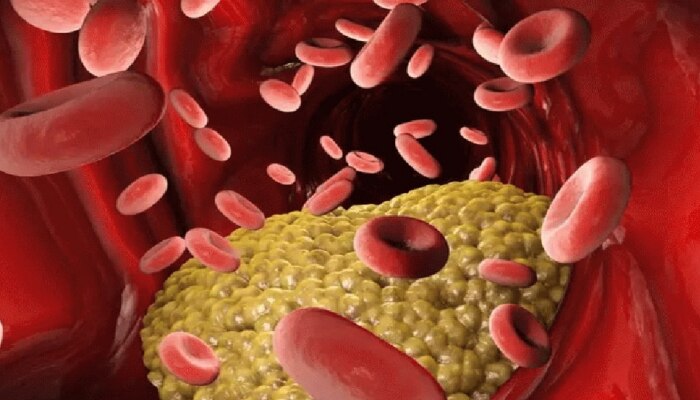 शरीरातील &#039;हे&#039; मुख्य 4 बदल वेळीच ओळखा; Cholesterol वाढण्याचे देतात संकेत