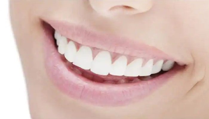 Teeth Health: थांबा...तुम्ही जे पदार्थ खाताय त्यामुळे दातांचं होतंय नुकसान! 