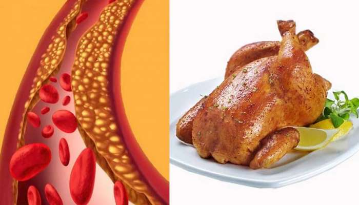 Cholesterol In Chicken: चिकन खाल्ल्याने कोलेस्ट्रॉल वाढतं का? जाणून घ्या आरोग्यदायी उपाय