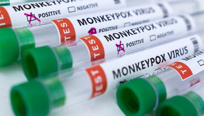 आता तासाभराच्या आत समजणार तुमच्या शरीरात Monkeypox Virus आहे का?