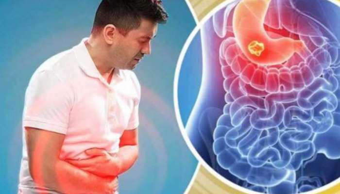 Gastric Problem Solutions: पोटाच्या समस्यावर घरगुती उपाय