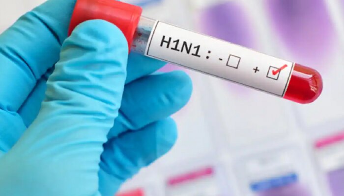 Swine Flu: राज्यात स्वाईन फ्लूने वाढवली चिंता, या आमदाराला ही लागण