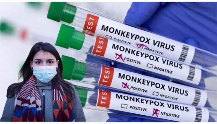 Monkeypox: मंकीपॉक्स व्हायरसचा पहिल्यांदाच माणसाकडून पाळीव प्राण्यांमध्ये फैलाव, जगातील पहिलीच केस समोर