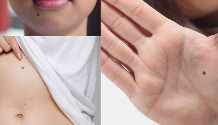 meaning of mole mark on various body parts of women belly ...