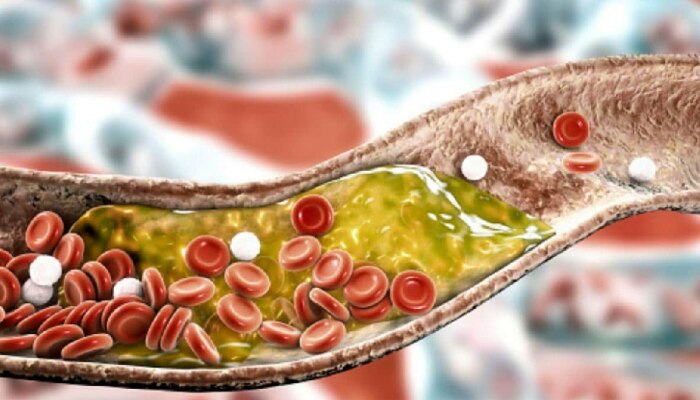 रक्तात जमा असलेलं Cholesterol कमी करतील तुमच्या किचनमध्ये असलेल्या गोष्टी!