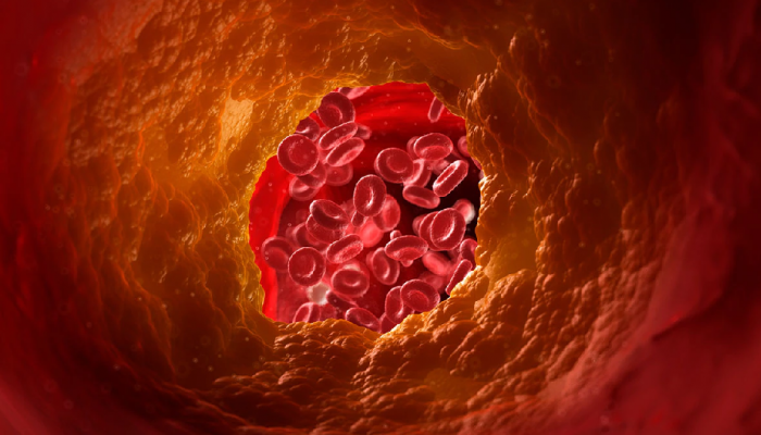 High Cholesterol: चालताना पायांमध्ये दिसून येतात हाय Cholesterol ची 'ही' लक्षणं