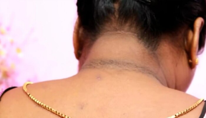 Dark Neck: मानेचा काळवंडलेपणा 10 रुपयांहून कमी किमतीत दूर करा, पाहा सर्वात सोपी पद्धत 