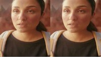 Parineeti Chopra च्या चेहऱ्याला झालं तरी काय? फोटोपाहून चाहत्यांना बसला धक्का 