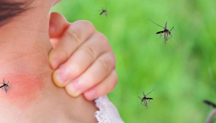 Mosquitoes Home Remedies: डासांच्या प्रादुर्भावामुळे हैराण, करा हे 4 घरगुती उपाय; तात्काळ आराम  