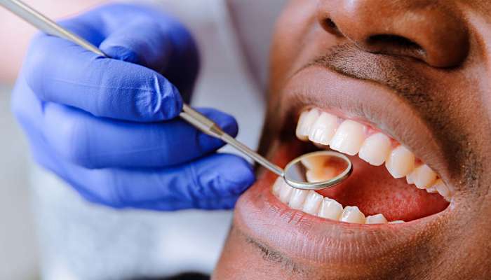 दात किडणे, हिरड्यांना सूज येणे बेतेल जीवावर, 75 टक्क्यांपर्यंत वाढते Liver Cancer Risk