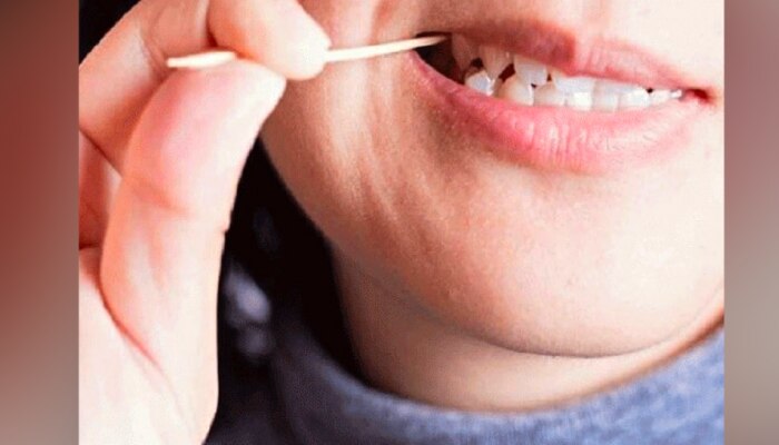 जेवणानंतर दात कोरत असाल तर सावधान, होऊ शकतं मोठं नुकसान!