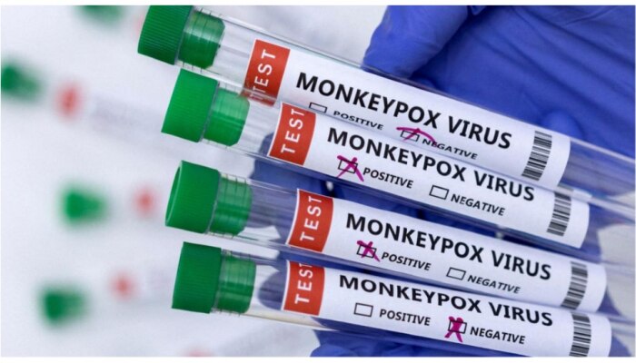 Monkeypox चा संबंध परदेशातून परतलेल्यांच्या त्वचेशी? नक्की काय आहे प्रकरण; वाचा