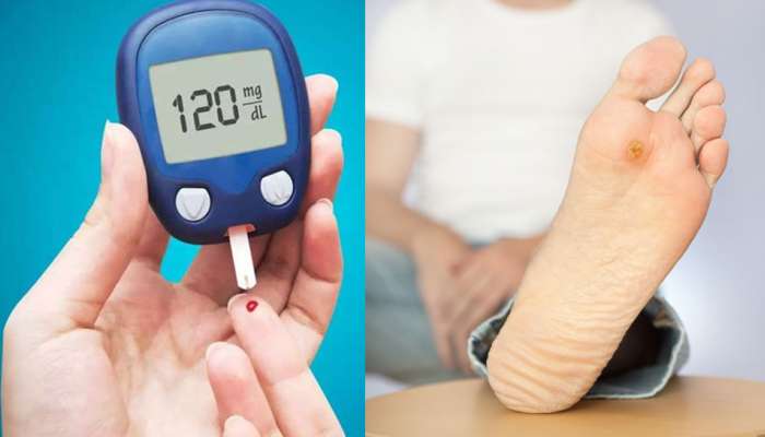 Diabetes होतो तेव्हा आपल्याला पाय देतात हे धोकादायक संकेत, तात्काळ करा Blood Sugar Test