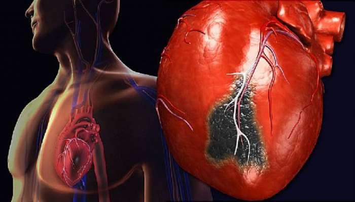 Heart attack : सावधान…! &#039;या&#039; वयोगटातील तरुणांना हृदयविकाराचा झटका; वाचा मोठे कारण