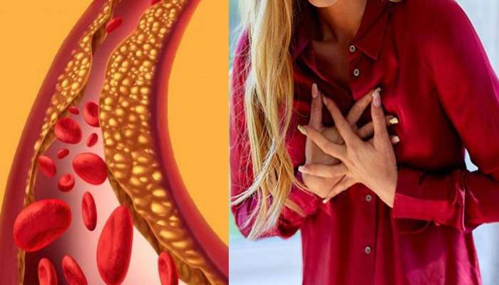 Heart Attack: महिलांमध्ये हार्ट अटॅक येण्यापूर्वी दिसतात ही लक्षणं, याकडे दुर्लक्ष करू नका