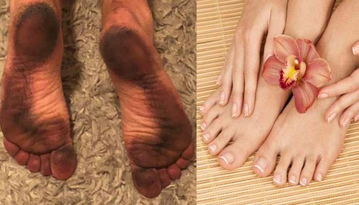 Feet Cleaning: वारंवार पाय जमिनीवर ठेवल्याने होतात घाण, अशा प्रकारे घालवा काळपटपणा