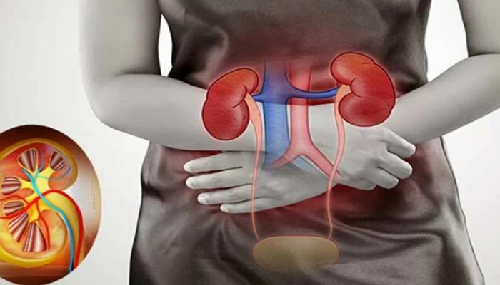 Kidney Stone Foods: &#039;हे&#039; पदार्थ खाऊ नका अन्यथा Kidney Stone धोका होऊ शकतो...