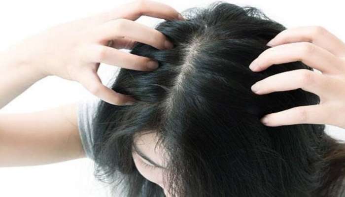 Hair Care Tips: केसांमध्ये डँड्रफ झाला आहे का? तर शॅम्पू करताना &#039;या&#039; गोष्टींचा वापर करा