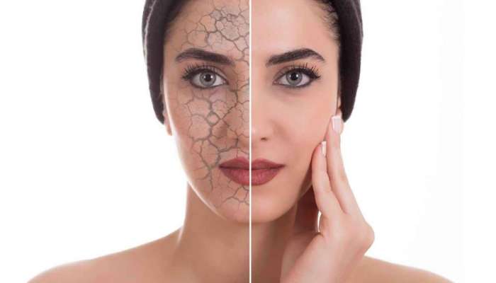 Skin Care: हवामान बदलताच त्वचेला तडे जातात, कोरडेपणा टाळण्यासाठी रात्री झोपताना या करा गोष्टी 