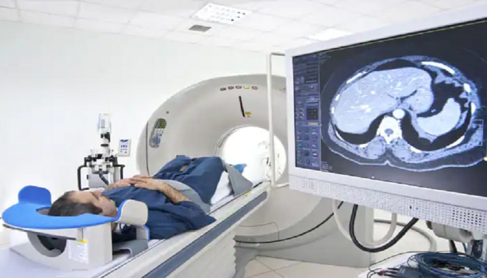 CT Scan नेमक्या कोणत्या आजारात केले जाते? जाणून घ्या