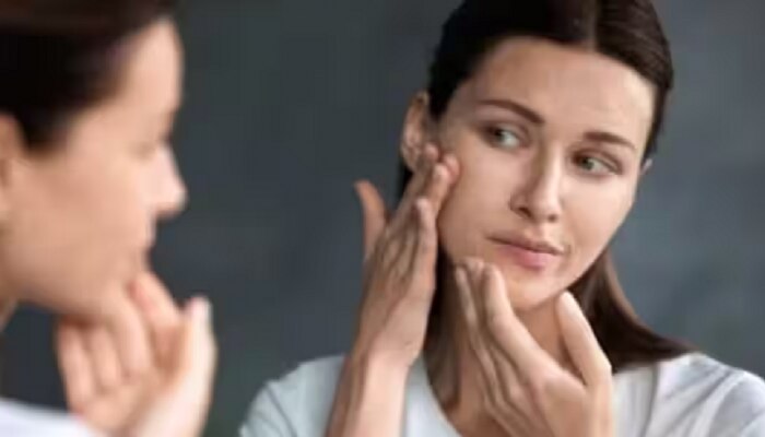 Skin Care Tips: तुमच्या चेहऱ्यावरील  व्रण घालवायचेत? फॉलो करा काही भन्नाट टिप्स