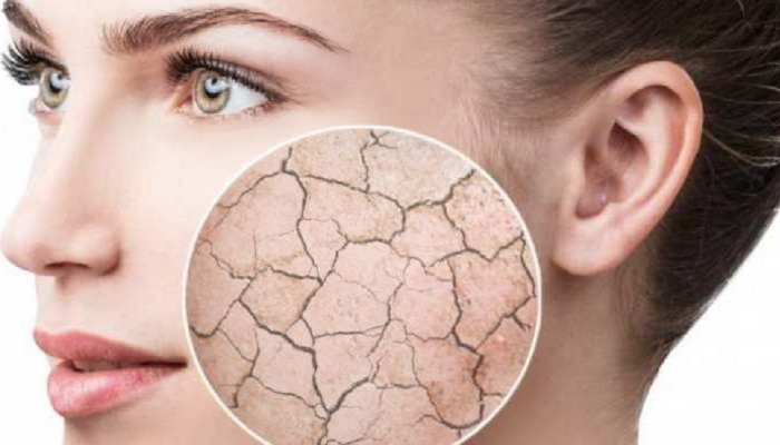 Skin Care : &#039;या&#039; कारणांमुळे त्वचा होते Dry, जाणून घ्या 