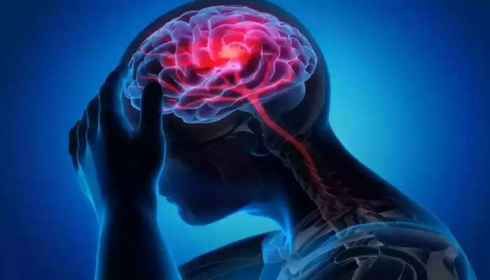 World Stroke Day: साखर आणि मिठाचे अतिसेवन करण्यापूर्वी ही बातमी वाचा! 