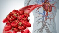 'या' कारणामुळे हृदयात होतायत blood clots; शरीरात दिसून येतील 'ही' लक्षणं