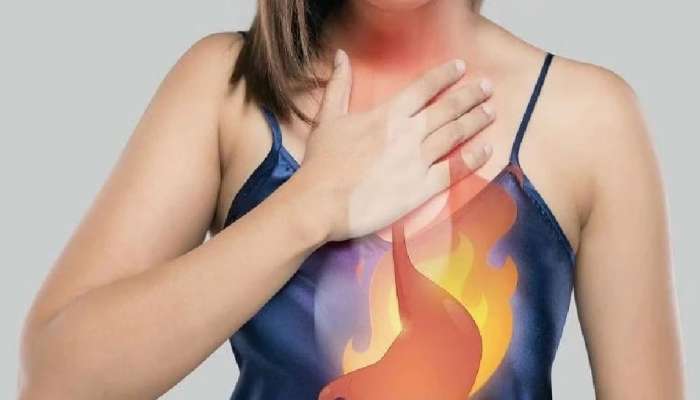 Acid Reflux: जेवल्यानंतर घशात होते जळजळ? कारण जाणून बसेल धक्का