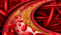 अयोग्य आहाराने वाढतंय रक्तातील High Cholesterol; केवळ 'हा' एक पदार्थ रोखू शकेल
