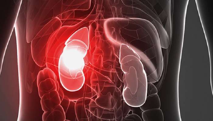 Signs of Kidney Problem : किडनी खराब होण्याची &#039;ही&#039; 5 चिन्हे चुकूनही दुर्लक्ष करू नका; नाहीतर होईल हा गंभीर आजार