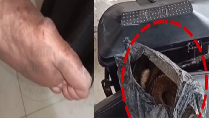 Viral Video : किंग कोब्रा माणसाला चावला आणि नंतर साप मेला...म्हणून माणसाने सापासोबत गाठलं हॉस्पिटल